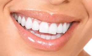 What Are Your Options if Traditional Teeth Whitening Doesn't Work?: Grace  Dental Group: General Dentistry