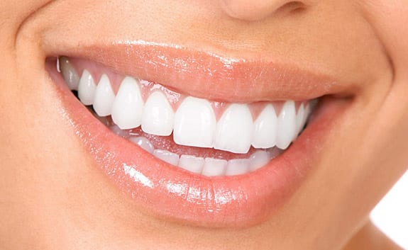 Teeth Whitening in Roswell GA