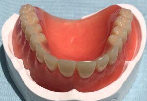 Dentures Roswell GA - Dentist Roswell GA - Sunshine Smiles Dentistry in Roswell Georgia 30075