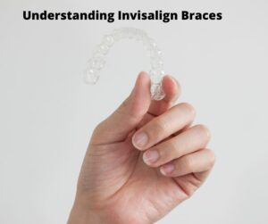 Invisalign Braces Roswell GA - Dentist Roswell GA - Sunshine Smiles Dentistry