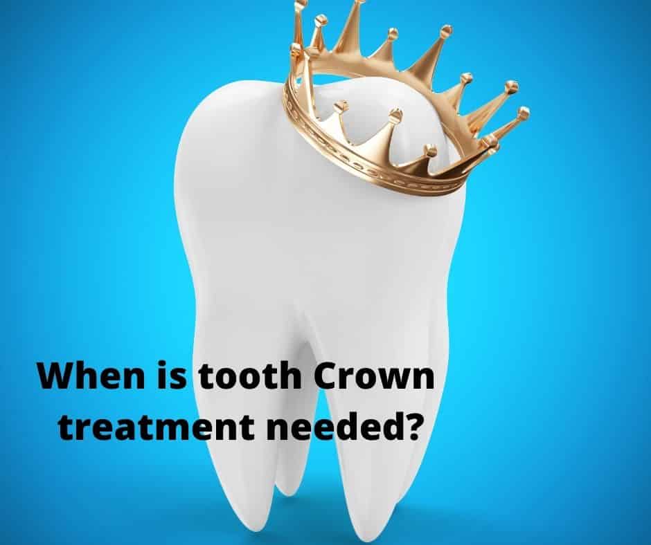 When is tooth Crown treatment needed