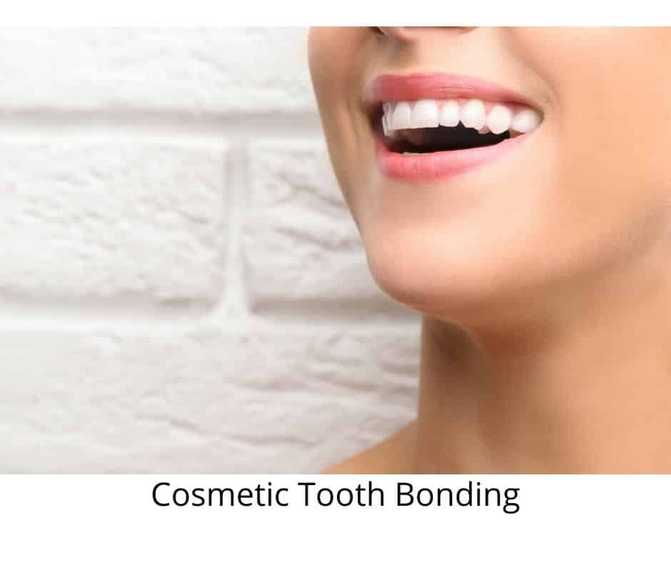 Cosmetic Tooth Bonding - Cosmetic Dentist Roswell, Georgia - Sunshine Smiles Dentistry