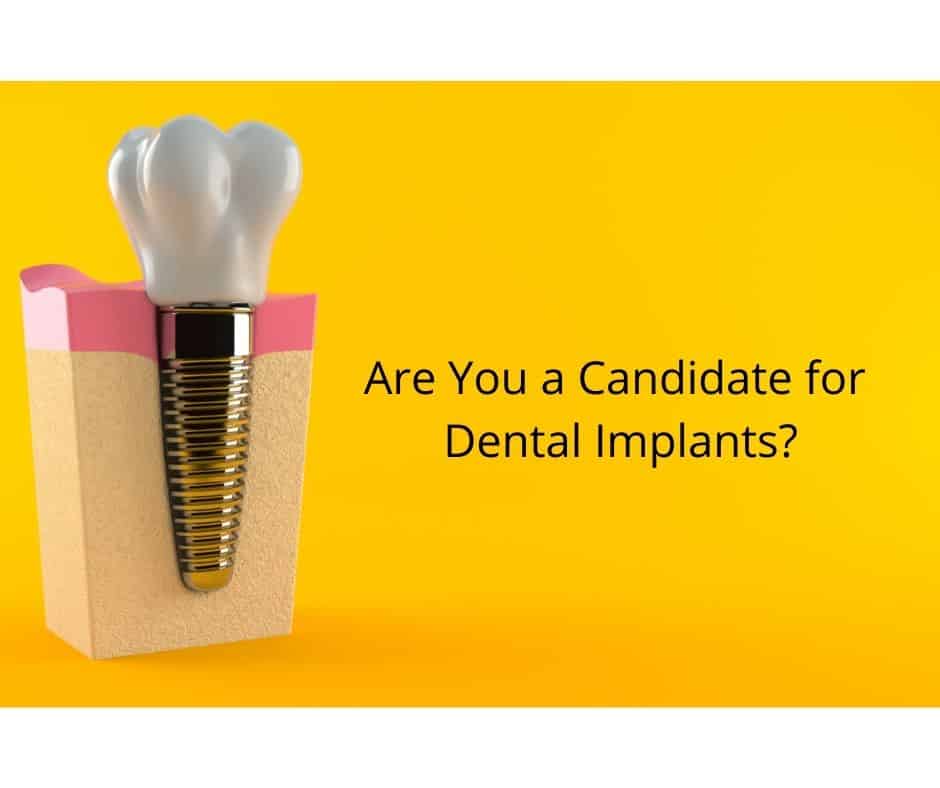 Are You a Candidate for Dental Implants - Sunshine Smiles Dentistry - Implant Dentist near Roswell, Georgia