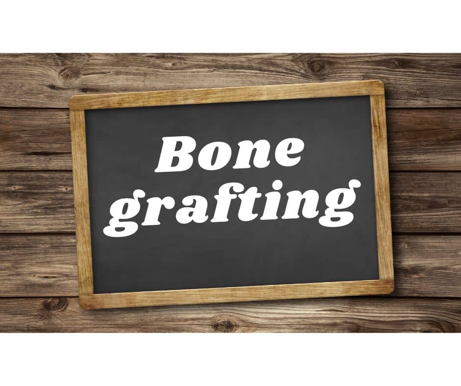 How does Bone Grafting for Dental Implants work - Sunshine Smiles Dentistry - dental implants near Roswell, Georgia