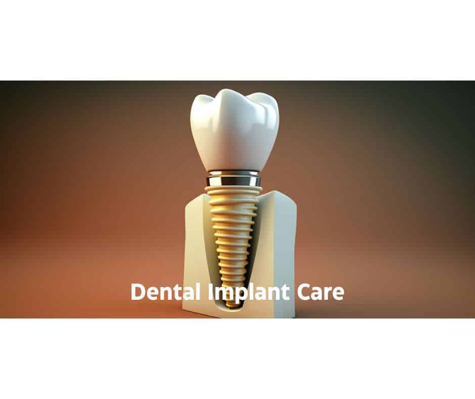 Dental Implant Care - Sunshine Smiles Dentistry - Dentist Roswell, GA