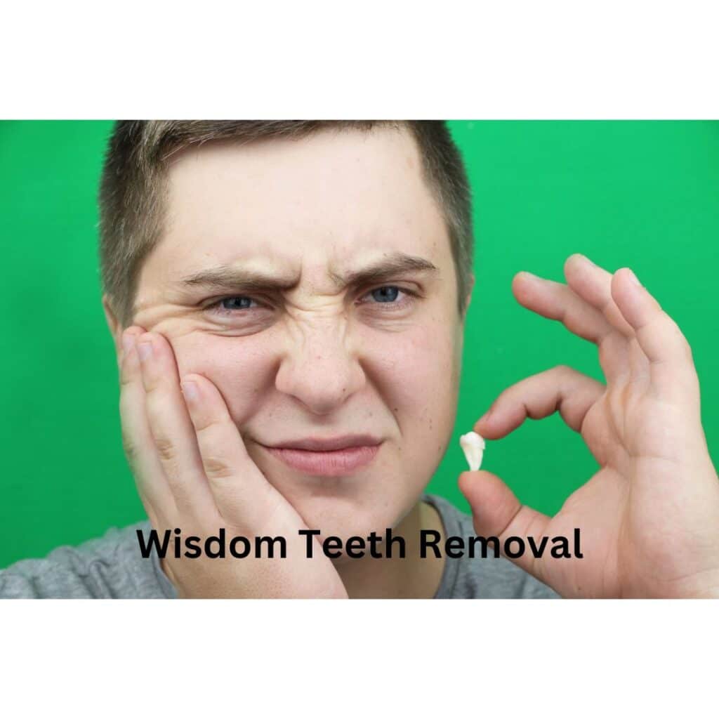 Wisdom Teeth Extraction - Dentist - Oral Surgeon - Sunshine Smiles Dentistry - Dentist Roswell Georgia