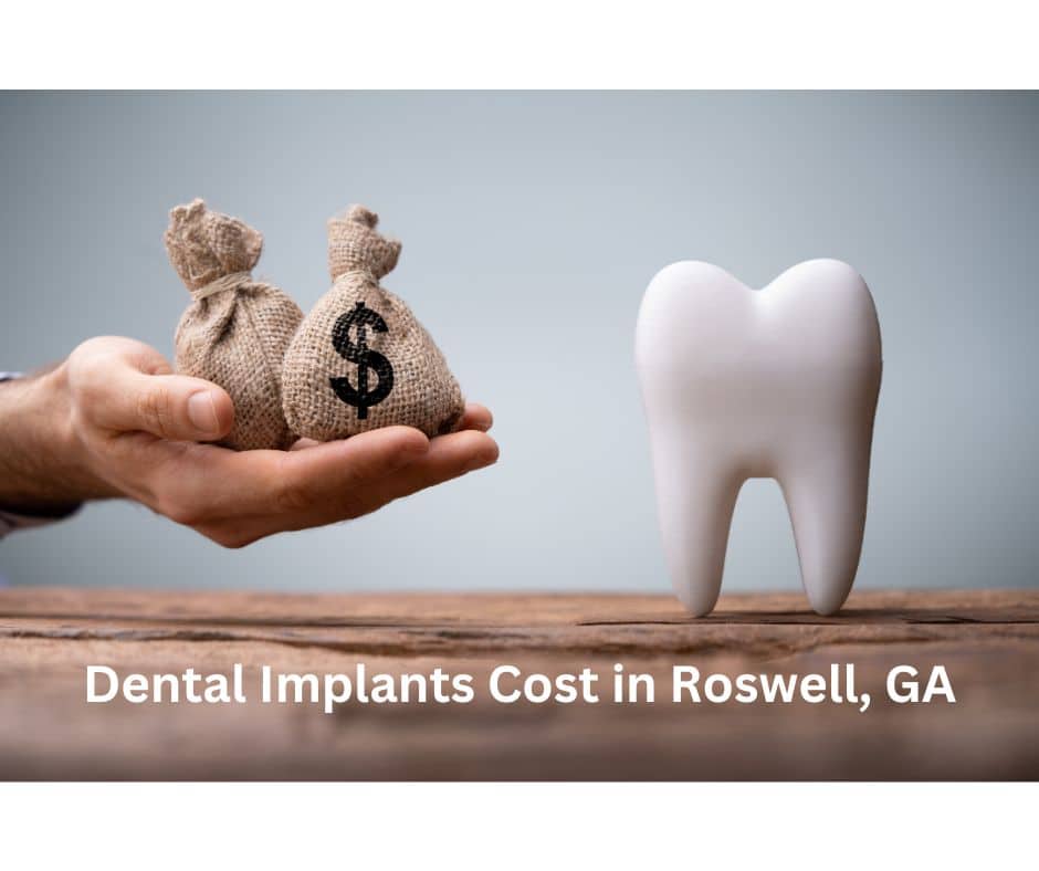 Dental Implants Cost in Roswell, GA