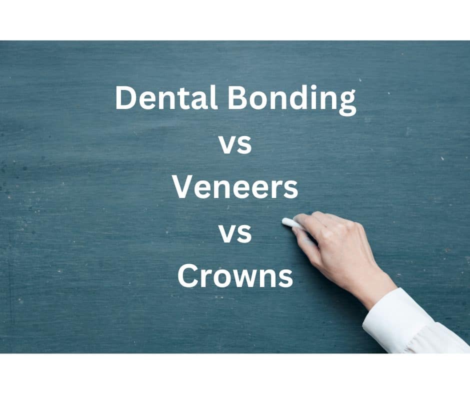 Dental Bonding vs Veneers vs Crowns for cracked front teeth near Roswell, Georgia