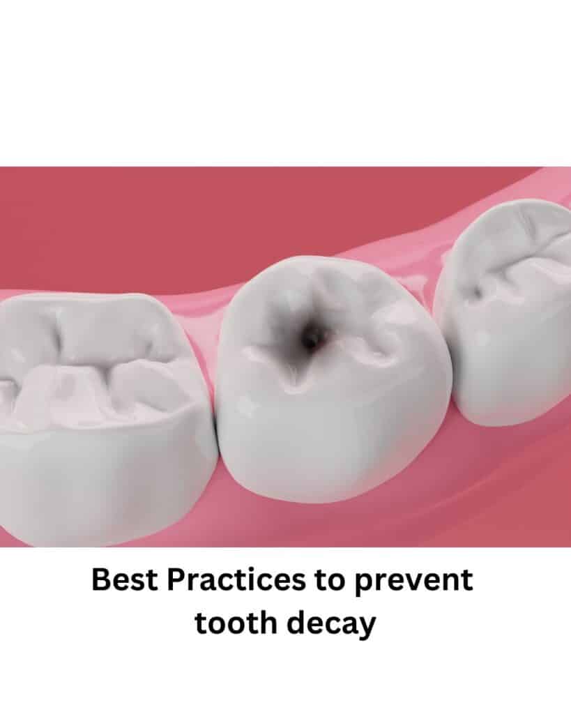 Best practices to prevent tooth decay